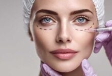 بلفاروپلاستی و کاربرد