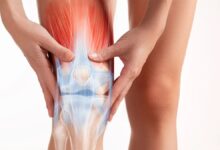 آرتروز و ورم پا