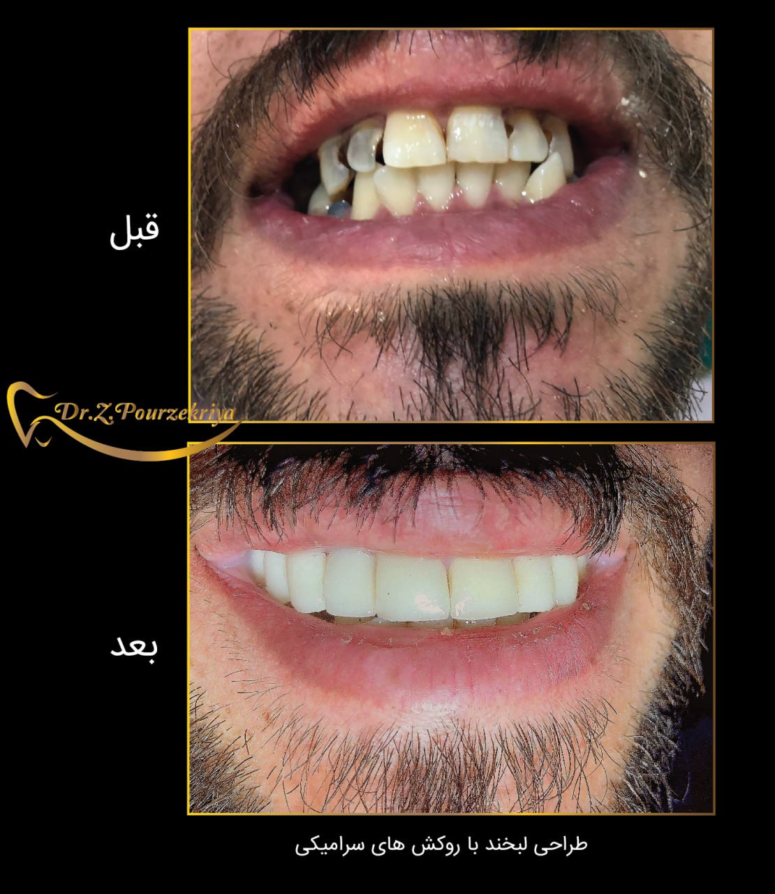 بهترین دندانپزشک در البرز