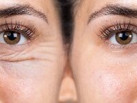 بهترین کلینیک جوانسازی پوست تهران