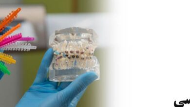 تجهیزات ارتودنسی ، خرید تجهیزات ارتودنسی ، خرید عمده تجهیزات ارتودنسی