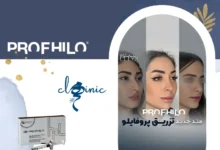 تزریق پروفایلو