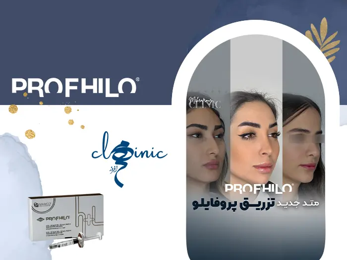 تزریق پروفایلو
