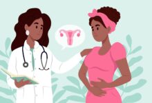 تفاوت لابیاپلاستی و واژینوپلاستی