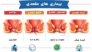خطرناک‌ترین بیماری‌های ناحیه مقعد