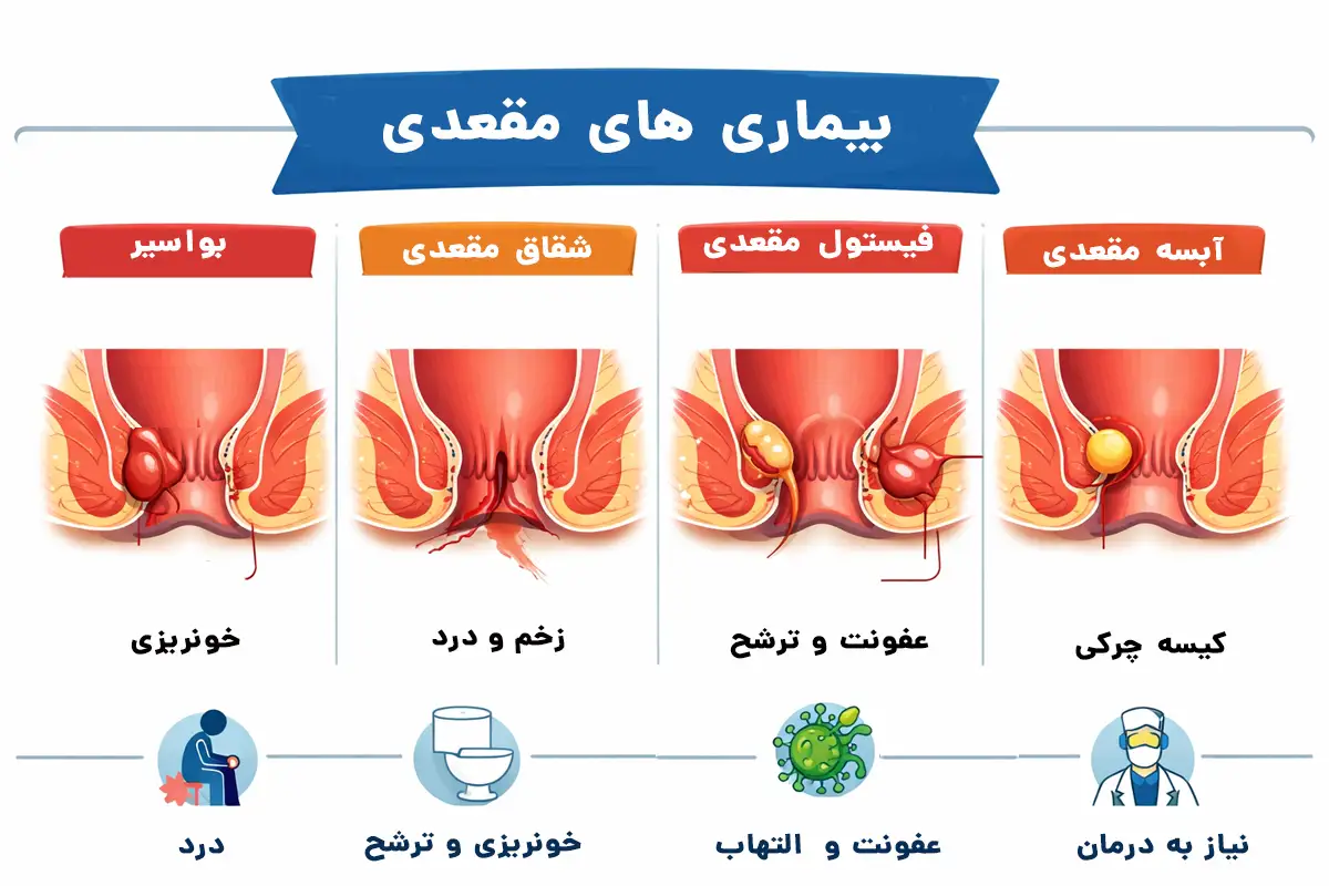 خطرناک‌ترین بیماری‌های ناحیه مقعد