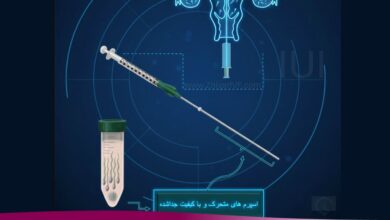 درمان ناباروری با روش iui