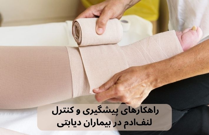 درمانگر در حال باند پیچی پا برای کنترل لنف‌ادم در بیماران دیابتی