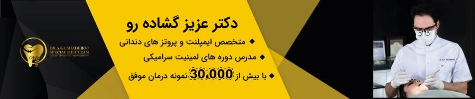دکتر عزیز گشاده رو جراح و متخصص ایمپلنت