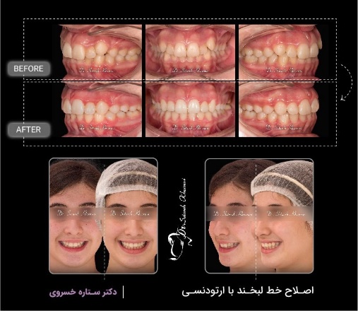 هزینه ارتودنسی در تهران