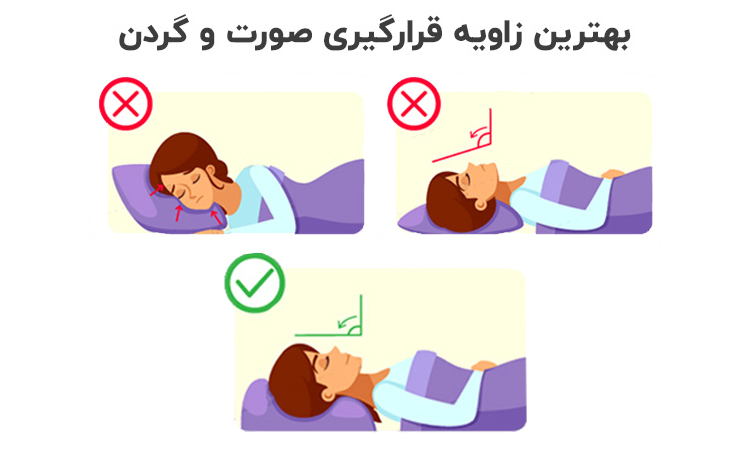 زاویه مناسب سر بعد از بلفاروپلاستی