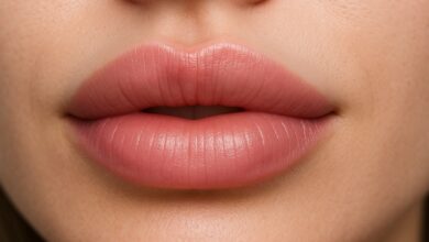 فیلر لب سوتی