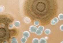 لومین تست بهارزیست