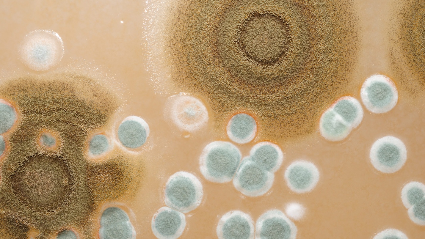 لومین تست بهارزیست