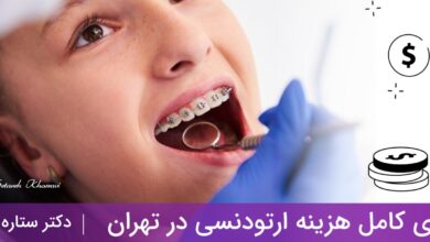 هزینه ارتودنسی در تهران
