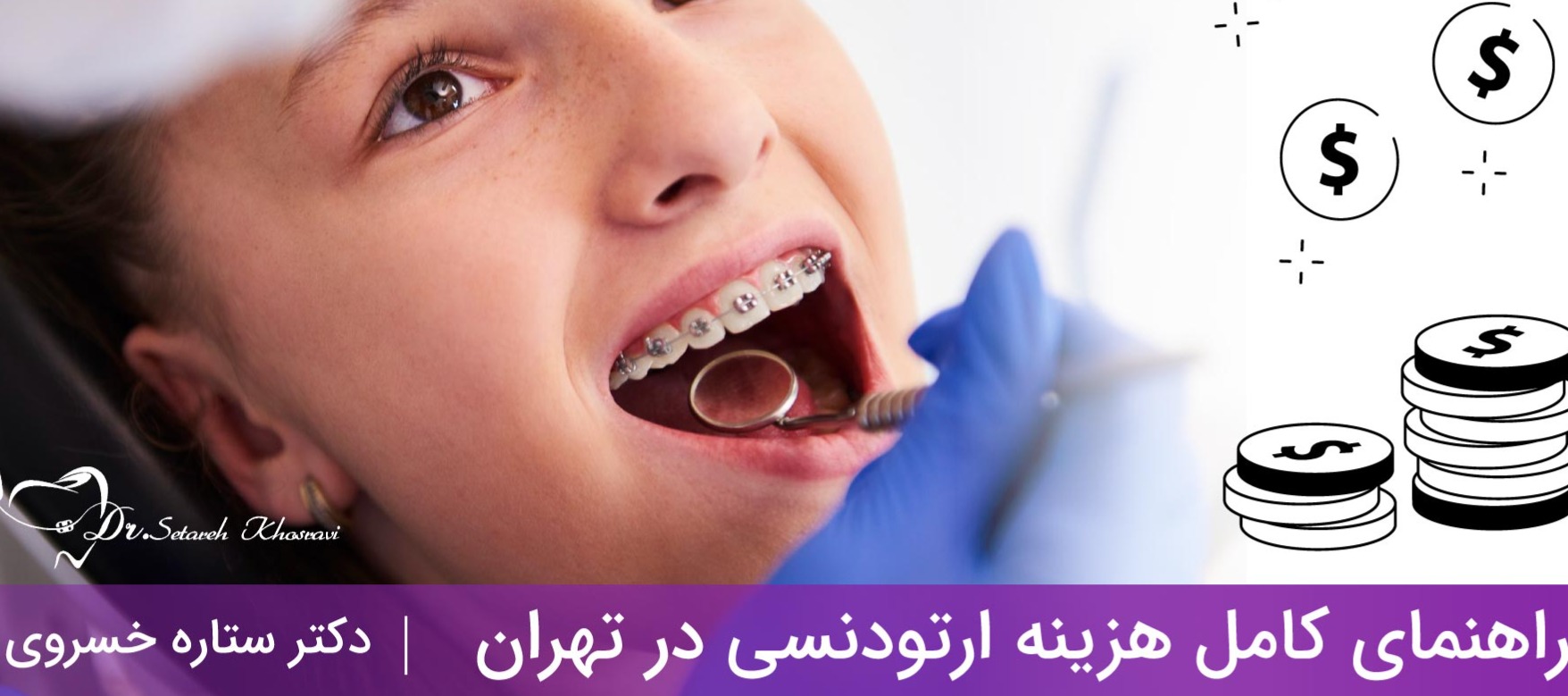 هزینه ارتودنسی در تهران