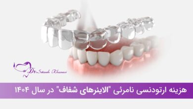 هزینه ارتودنسی نامرئی در سال 1404