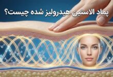 پماد الاستین هیدرولیزی چیست؟