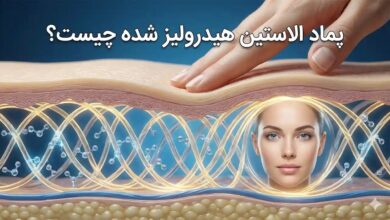 پماد الاستین هیدرولیزی چیست؟