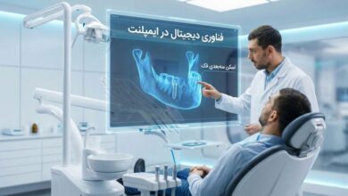 چگونه بدن ایمپلنت‌های خارجی را می‌پذیرد؟