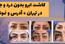 جدیدترین روش کاشت ابرو در ایران - میکروکاشت ابرو (کاشت ابرو به روش میکروگرافت و نانو کاشت ابرو) (micrograft-nanograft)