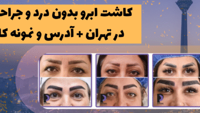 جدیدترین روش کاشت ابرو در ایران - میکروکاشت ابرو (کاشت ابرو به روش میکروگرافت و نانو کاشت ابرو) (micrograft-nanograft)