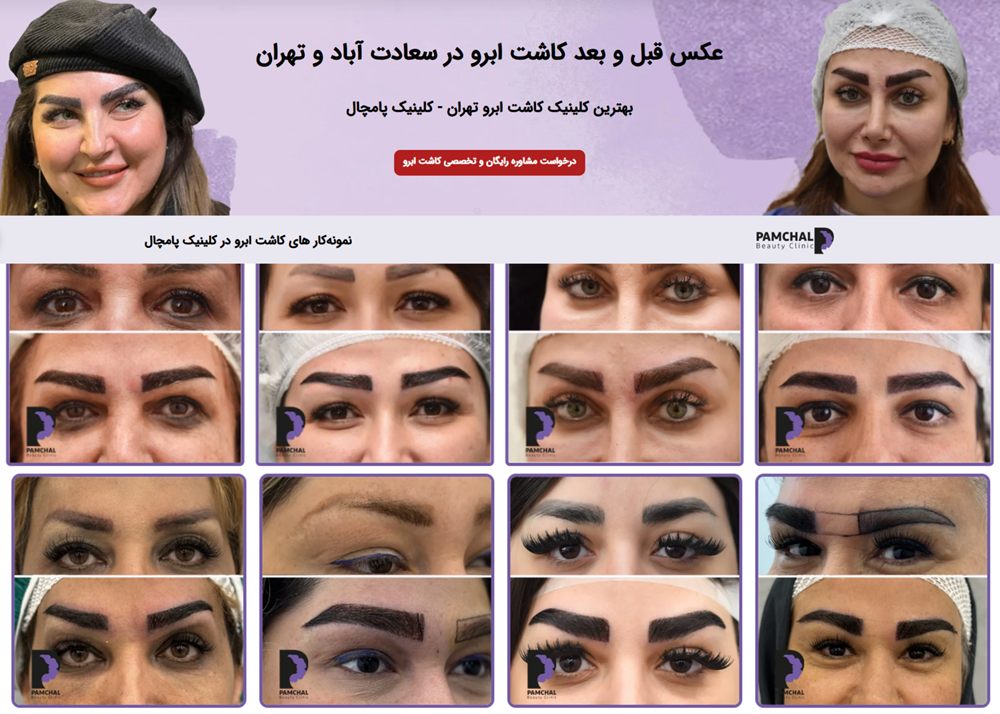 کاشت ابرو میکروگرافت بدون جراحی تهران سعادت آباد شهرک غرب تجریش تهران